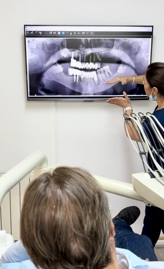 Diagnóstico dental con radiografía en Badalona